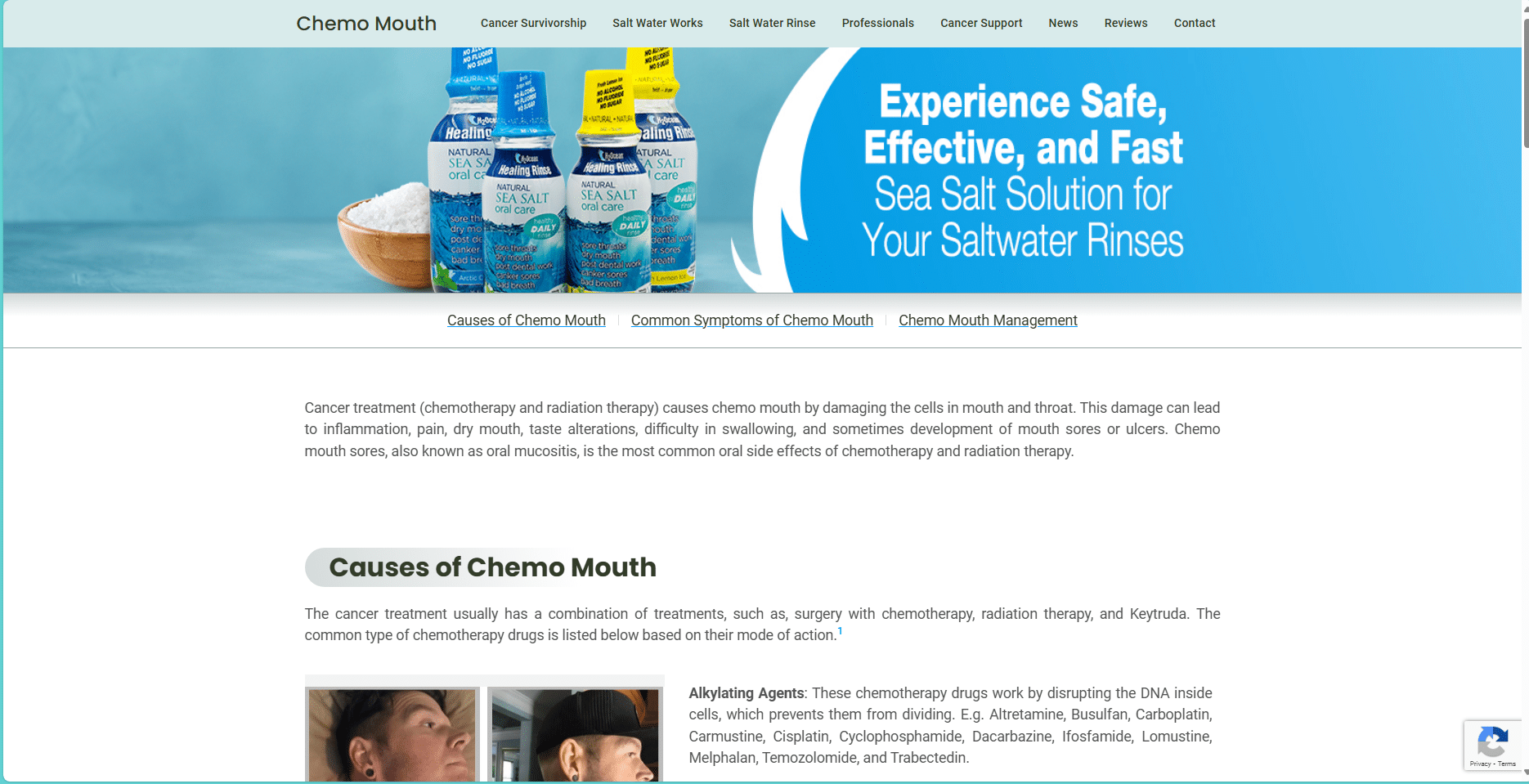 Chemo Mouth